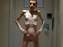 Anorexia Christin showing her Stiffys & Skinny Skeleton Anorexia Christin showing her Stiffys & Skinny Skeleton