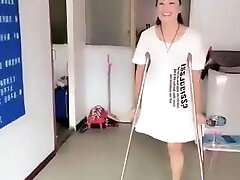 Chinese amputee girl