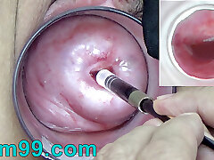Chinese Endoscope Camera inside Cervix Cam into Vagina