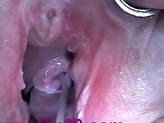 Jizz Injection with Syringe in Cervix Uterus after Tearing Up