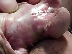 Must see male squirting with subincision
