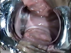 Insanely horny gynecologist inserts sodok pantat putih into his patients pussy