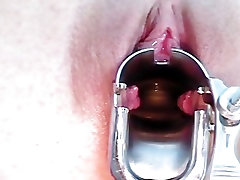 Shandi getting her pussy porn milf pictures speculum examined