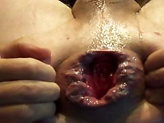 man-cunt grinding ass dick prolapse anal hole stretched asshole