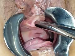 Peehole and speculum play