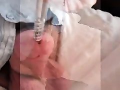 dilatador uretral inserción corrida