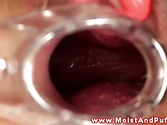 Puffy peach teen plays with speculum