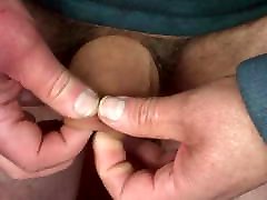 Foreskin with 3 dice and a plastic lid