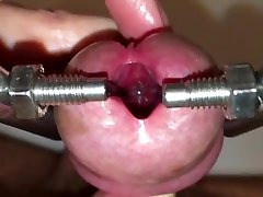 urethral stretching with lip grip orgasm device