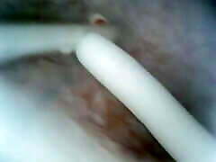 look inside bladder with endoscope and inject white lube