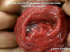 Sindy Rose, extreme anal fisting, ts serbia & prolapse 16 to 30