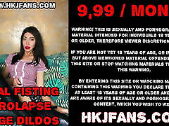 Huge XO speculum open to the max – japani rani hole of Hotkinkjo.