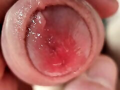 Close-Up Wet Foreskin life action video Play