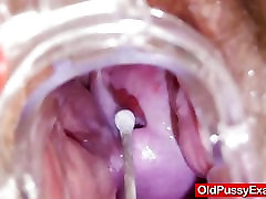 Spiky-looking mature getting a gyno