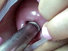 Lesbian piss inside the Uterus of other with tube in PeeHole