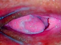 Juicy blood boor se Close Up