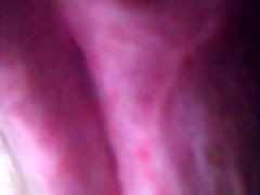 glans splitt glans splitt
